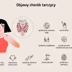 Ilustracja pokazuje, gdzie jest tarczyca, i objawy jej chorób: zmęczenie, problemy z wagą, skórą, paznokciami, sercem, włosami i pamięcią.