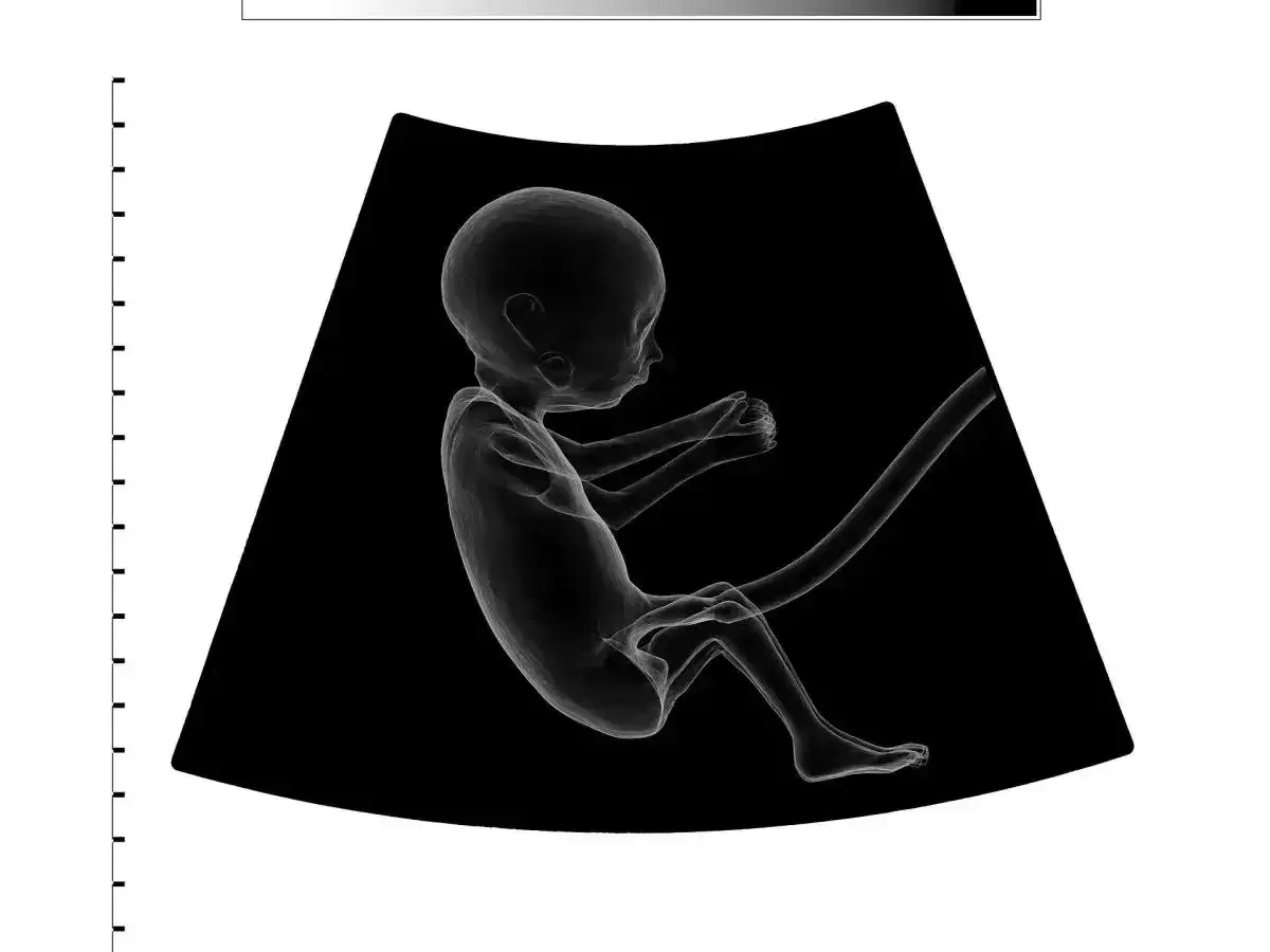 Hipotrofia - co oznacza i kiedy wymaga leczenia?