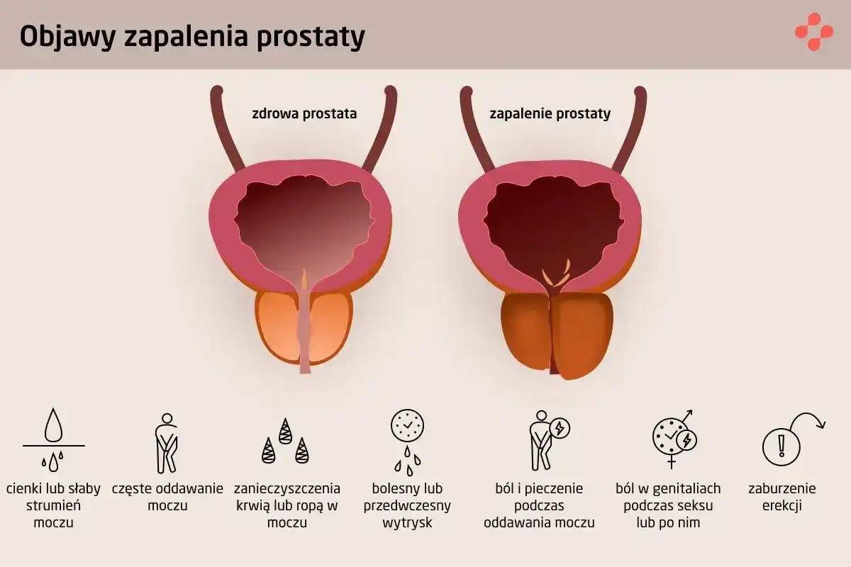 Prostata - budowa, funkcje i objawy, których nie warto ignorować