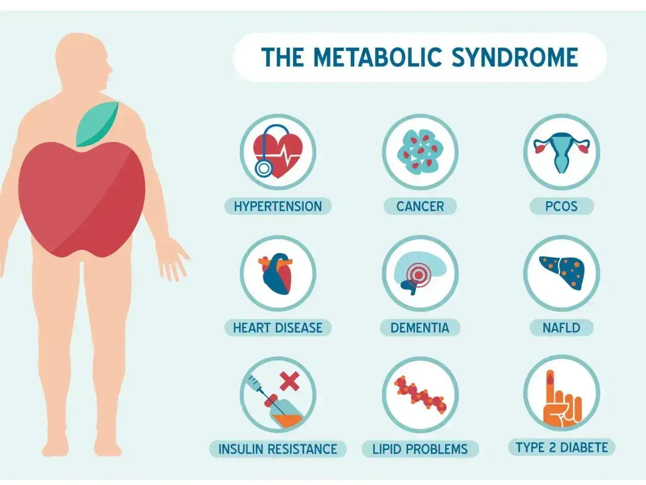 Ilustracja przedstawia ludzką sylwetkę z jabłkiem w brzuchu, symbolizującą zespół metaboliczny. Obok ikony wskazują na nadciśnienie, raka, PCOS, choroby serca, demencję, NAFLD, insulinooporność, problemy z lipidami i cukrzycę typu 2.
